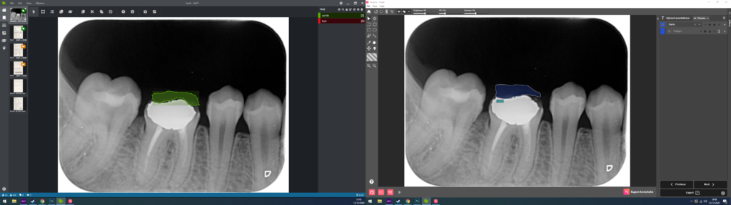 image segmentation tools vott super annotate